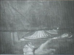 x-ray girl with pearl