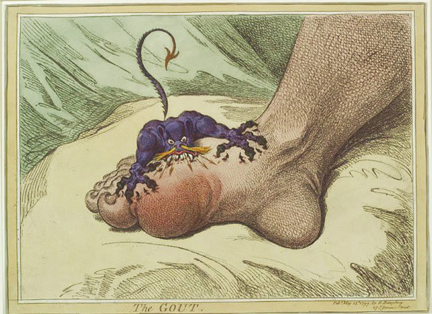 Gillray painting, The Gout